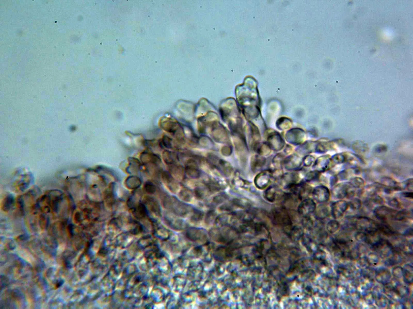 Microscopía de Resupinatus applicatus - 10 - Queilocistidios 2